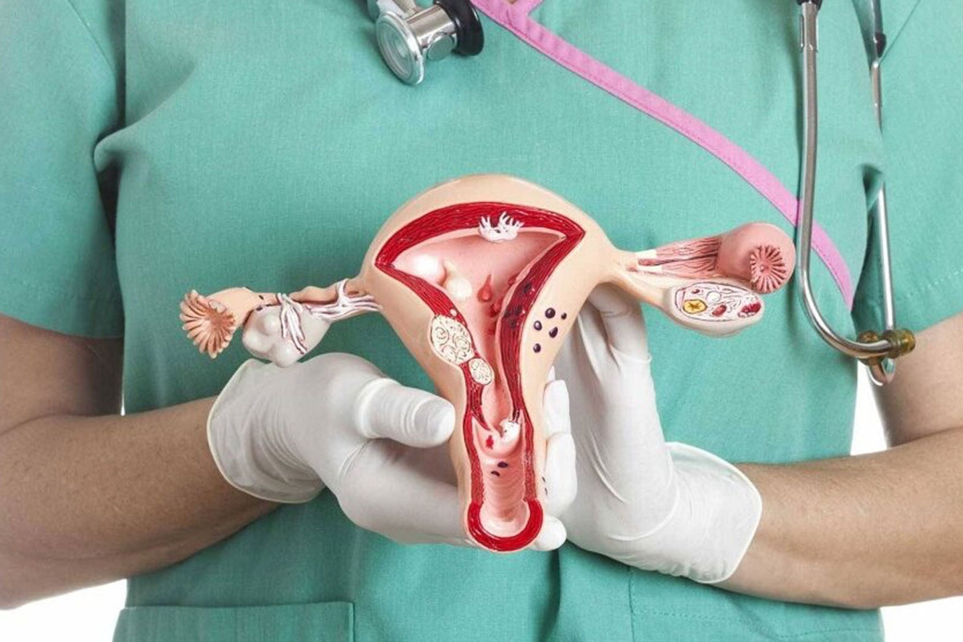 Cirurgia Geral / Ginecológica - Endometriose 